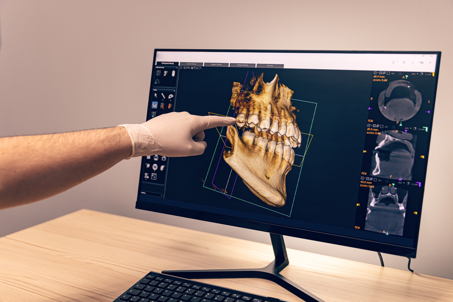 Tela de computador com a imagem de um ultrassom dental.